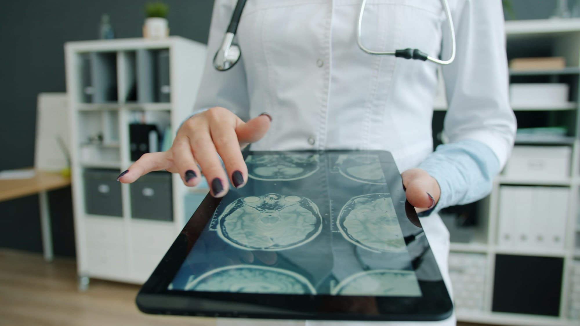 Clinician reviewing AI-assisted medical imaging